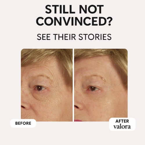 Valora Silicone Collagen Patches