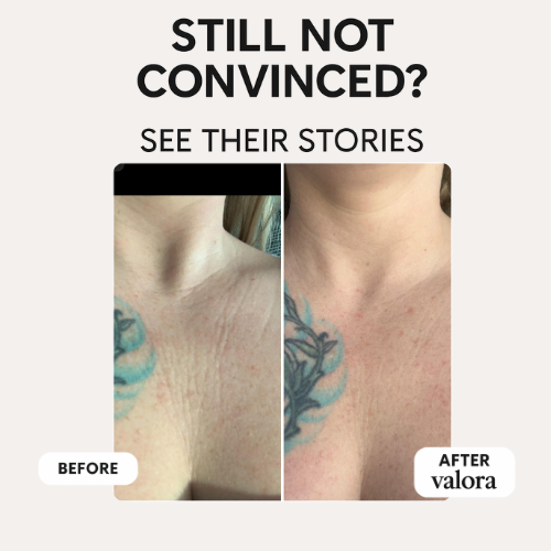 Valora Silicone Collagen Patches