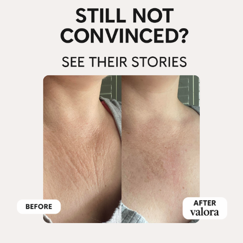 Valora Silicone Collagen Patches