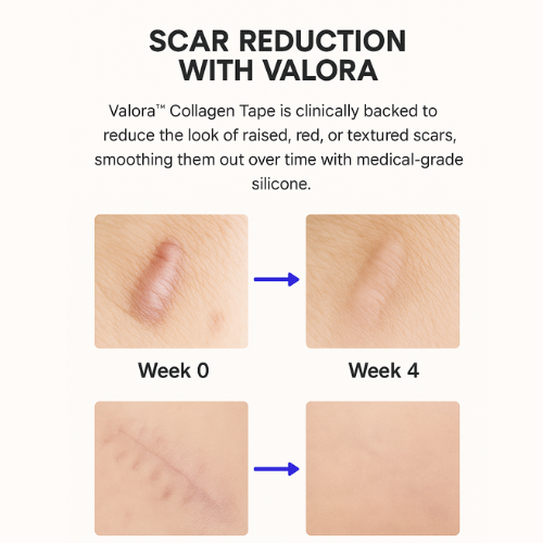 Valora Silicone Collagen Patches