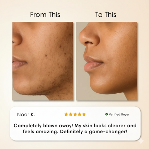 Valora Cyperus Rotundus Hair Removal Serum