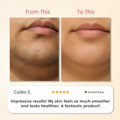 Valora Cyperus Rotundus Hair Removal Serum