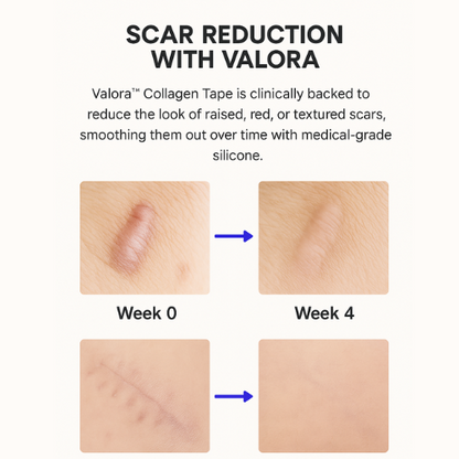 Valora Silicone Collagen Patches