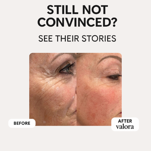Valora Silicone Collagen Patches