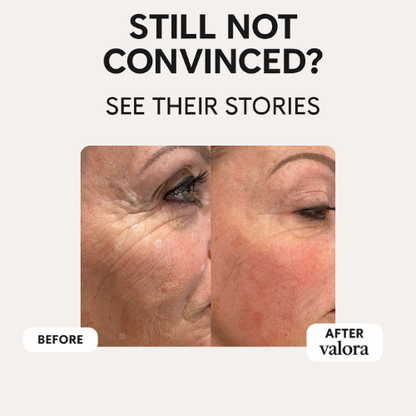 Valora Silicone Collagen Patches