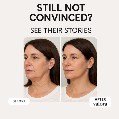 Valora Liquid-Microneedling Exosome
