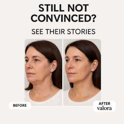 Valora Liquid-Microneedling Exosome