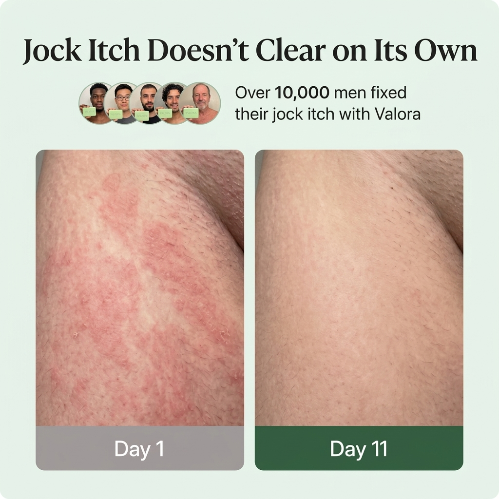 Organic Antifungal Relief Soap