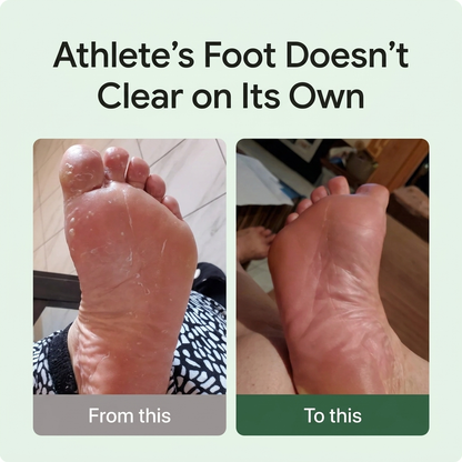 Organic Antifungal Relief Soap