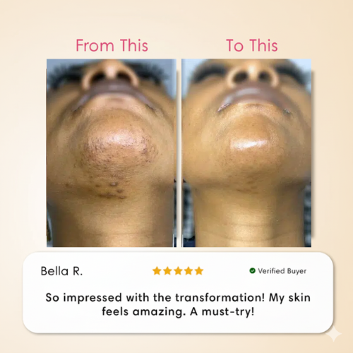 Valora Cyperus Rotundus Hair Removal Serum